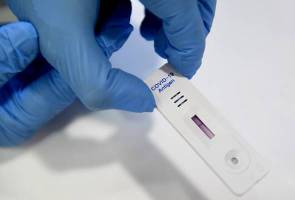 Lapor status ujian kendiri COVID-19 di MySejahtera – JPBN Sarawak Lapor status ujian kendiri COVID-19 di MySejahtera – JPBN Sarawak