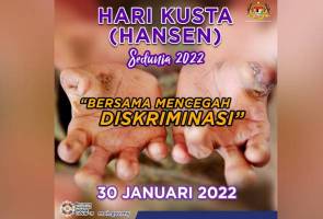 Kusta bukan penyakit keturunan, sumpahan, masyarakat perlu cegah diskriminasi – Khairy