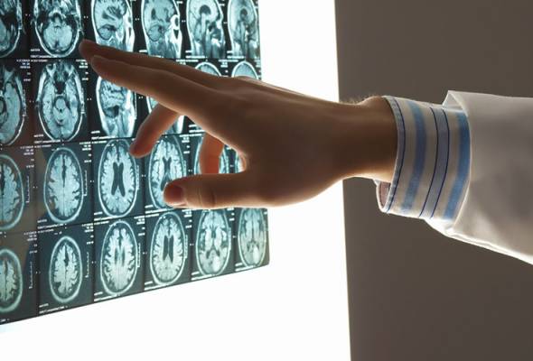 Potential 'game-changer' in diagnosing Parkinson's disease