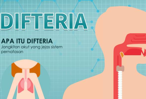 Kanak-kanak terbabit tidak pernah menerima sebarang imunisasi sejak lahir dan mula mengalami demam, batuk dan bengkak tonsil 16 Feb lalu. Kanak-kanak lelaki meninggal dunia di Johor Bahru akibat difteria