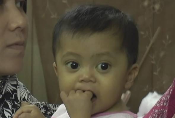 Bayi hidap barah hati perlu bantuan segera Bayi hidap barah hati perlu bantuan segera