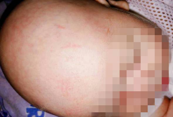 Kerap menangis: Tergamak bapa gigit kepala, lambung bayi sampai lebam Kerap menangis: Tergamak bapa gigit kepala, lambung bayi sampai lebam