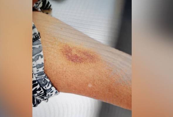 Anak belasah ibu kerana lambat sediakan makanan dan enggan beri wang Anak belasah ibu kerana lambat sediakan makanan dan enggan beri wang