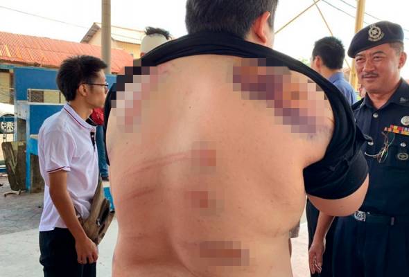 Cedera bergaduh gara-gara 'awek' Cedera bergaduh gara-gara 'awek'