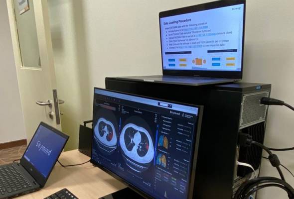 Diagnostik AI Wuhan sepantas 10 saat kini tiba di Malaysia Diagnostik AI Wuhan sepantas 10 saat kini tiba di Malaysia
