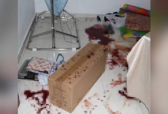 Suami disiasat kerana kelar tangan sendiri selepas bergaduh Suami disiasat kerana kelar tangan sendiri selepas bergaduh