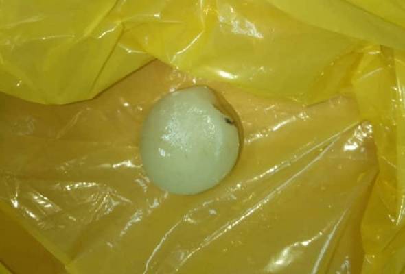 Kanak-kanak lelaki tiga tahun meninggal dunia tercekik rambutan Kanak-kanak lelaki tiga tahun meninggal dunia tercekik rambutan