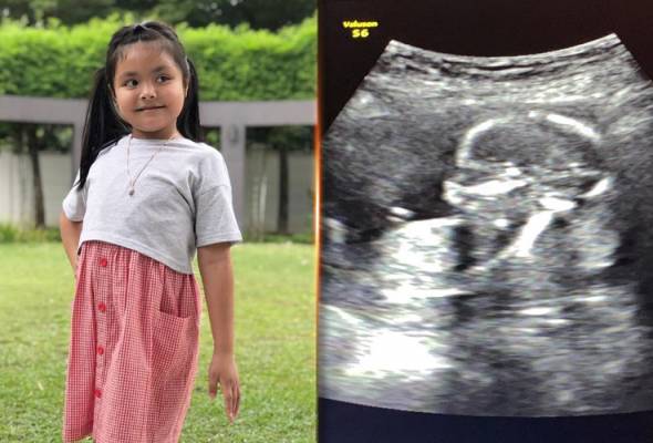 We are very excited for you - Lara Alana tak sabar nak jumpa adik baru We are very excited for you - Lara Alana tak sabar nak jumpa adik baru