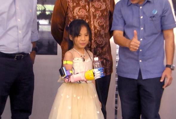 Perak mahu hasilkan tangan palsu bantu OKU Perak mahu hasilkan tangan palsu bantu OKU