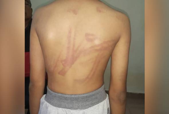 Kanak-kanak sembilan tahun jadi mangsa dera diselamatkan Kanak-kanak sembilan tahun jadi mangsa dera diselamatkan