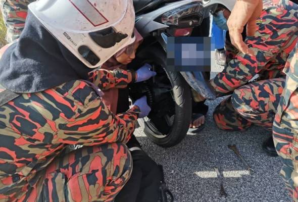 Remaja perempuan tahan sakit 20 minit, tangan tersepit 'sprocket' motosikal Remaja perempuan tahan sakit 20 minit, tangan tersepit 'sprocket' motosikal