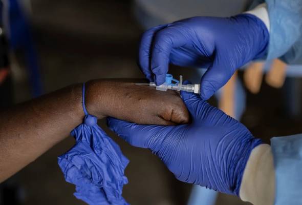Ethiopia Laksana Langkah Drastik: Pemeriksaan Kesihatan Ketat Bendung Penularan MPOX – Bayi Dikesan Positif!