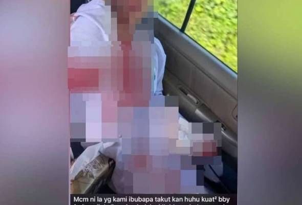 Murid cedera terkena tali pinggang berpunca daripada salah faham – Polis