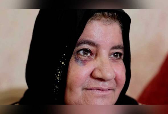 Hanya memetik buah zaitun, wanita Palestin cedera diserang peneroka haram Israel