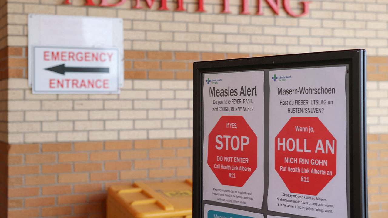 Kanada kehilangan status bebas campak, AS berisiko mengikut jejak